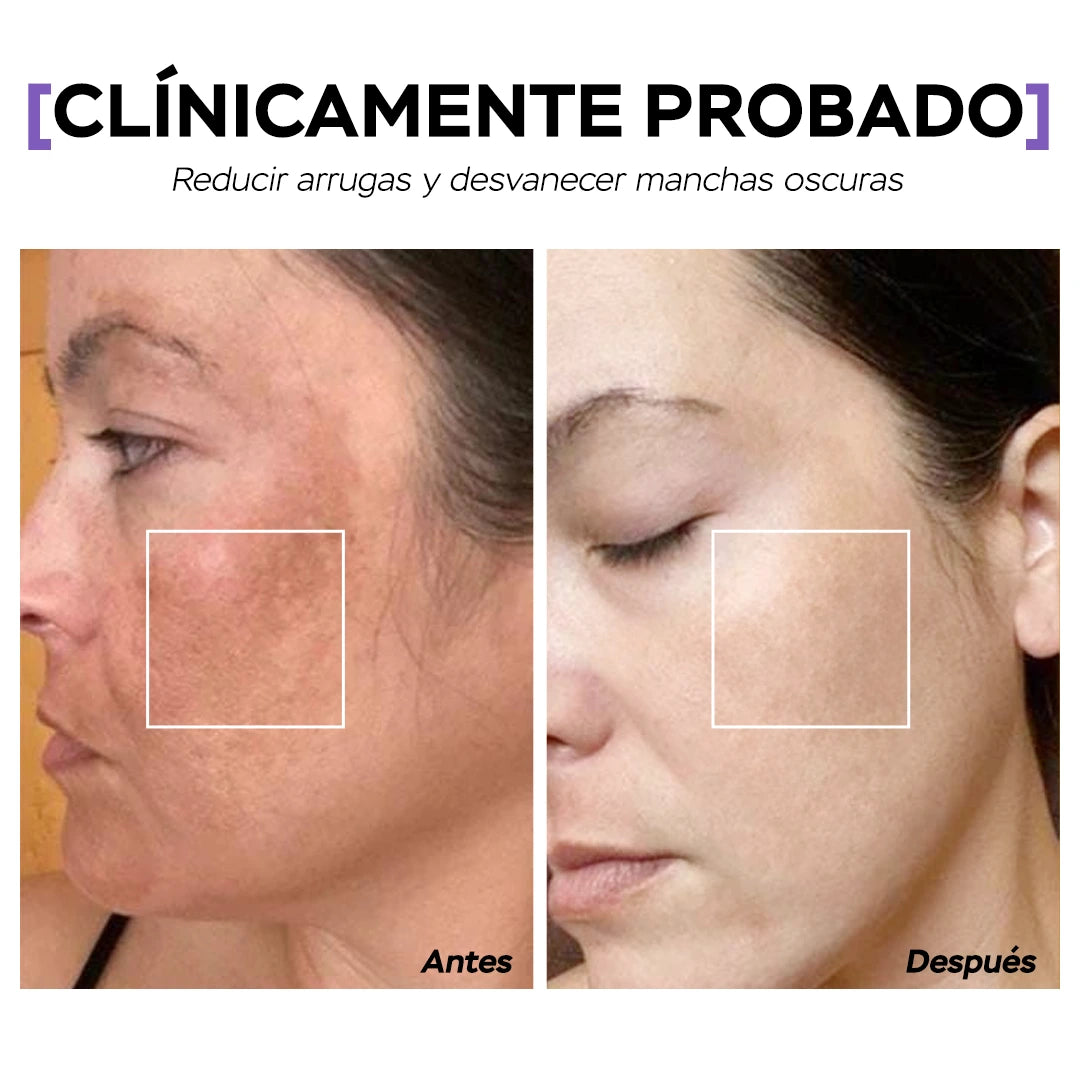 Seyoul™ Mascarilla en Película - H01