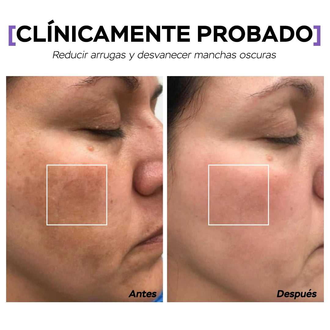 Seyoul™ Mascarilla en Película - H01